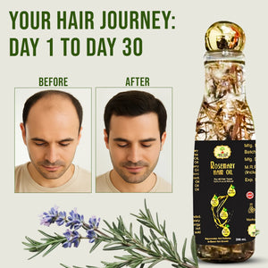 Rosemary Hair Oil Ayurveda - Natural Hair Growth & Scalp Nourishment- Shivveda